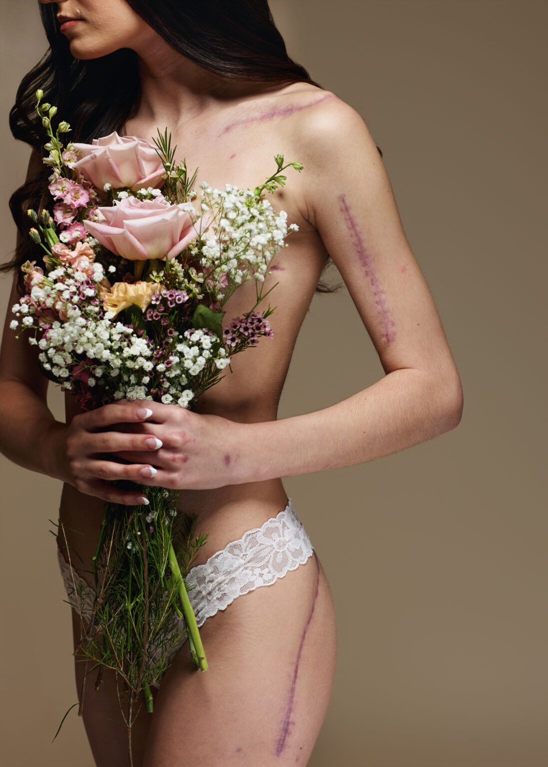 woman with scars holding flowers